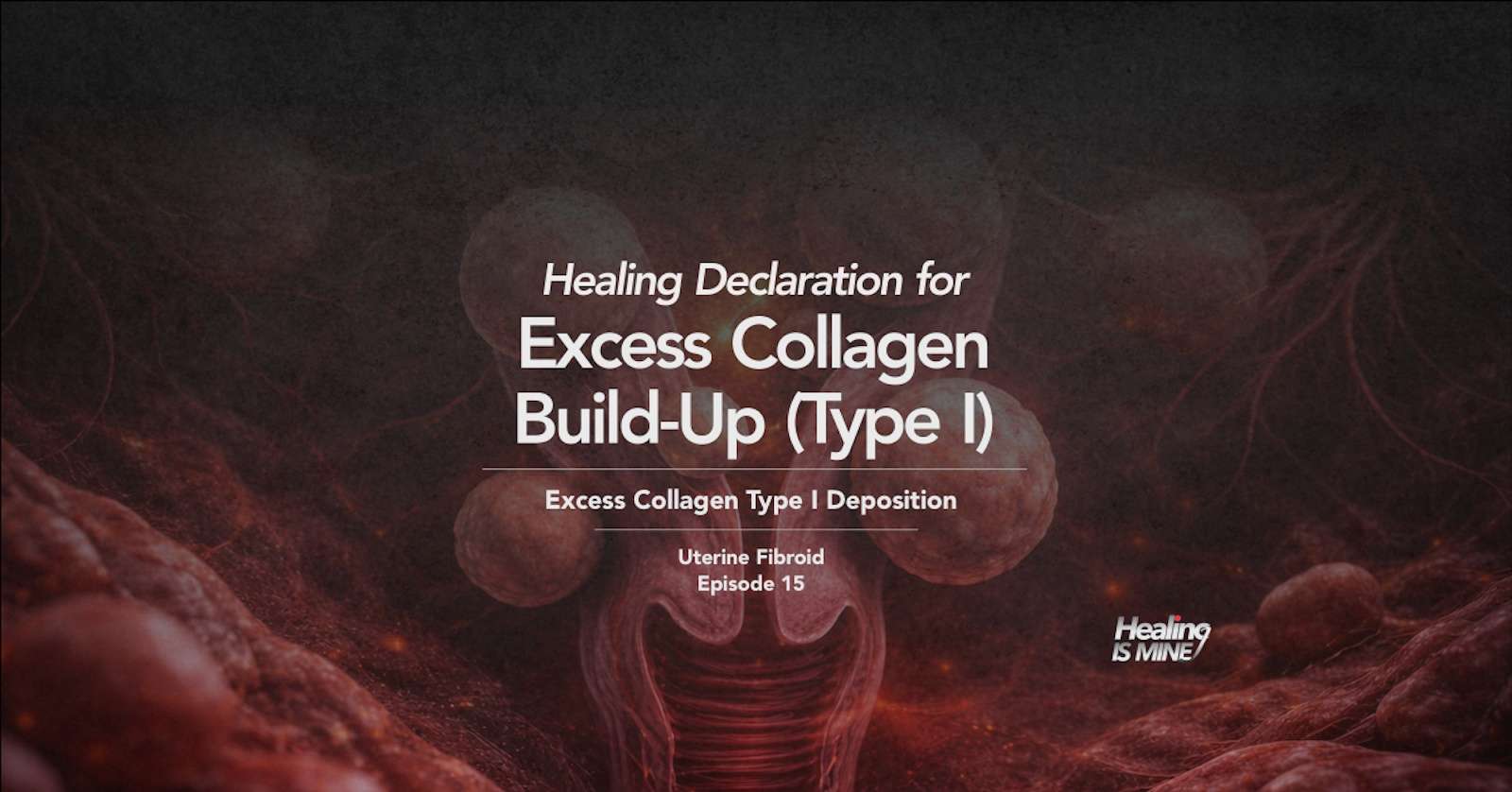 Excess collagen build-up (Type I) (Excess collagen type I deposition) - Uterine fibroid nodules surrounded by dense type I collagen accumulation within myometrial tissue illustration