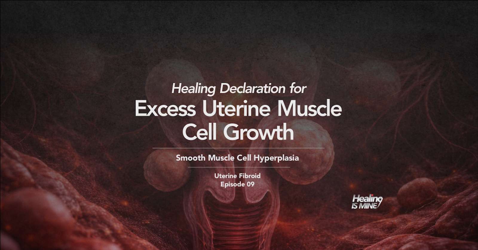 Excess uterine muscle cell growth (Smooth muscle cell hyperplasia) n uterine fibroids visualized in uterine tissue