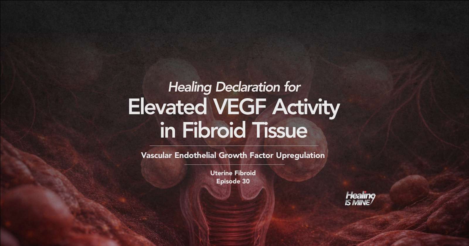 Highly vascularized uterine fibroid nodules within uterine wall representing elevated VEGF activity in fibroid tissue (vascular endothelial growth factor upregulation)