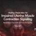 Uterine fibroid nodules distorting uterine wall with impaired uterine muscle contraction signaling (altered smooth muscle contractile signaling) in myometrial tissue illustration