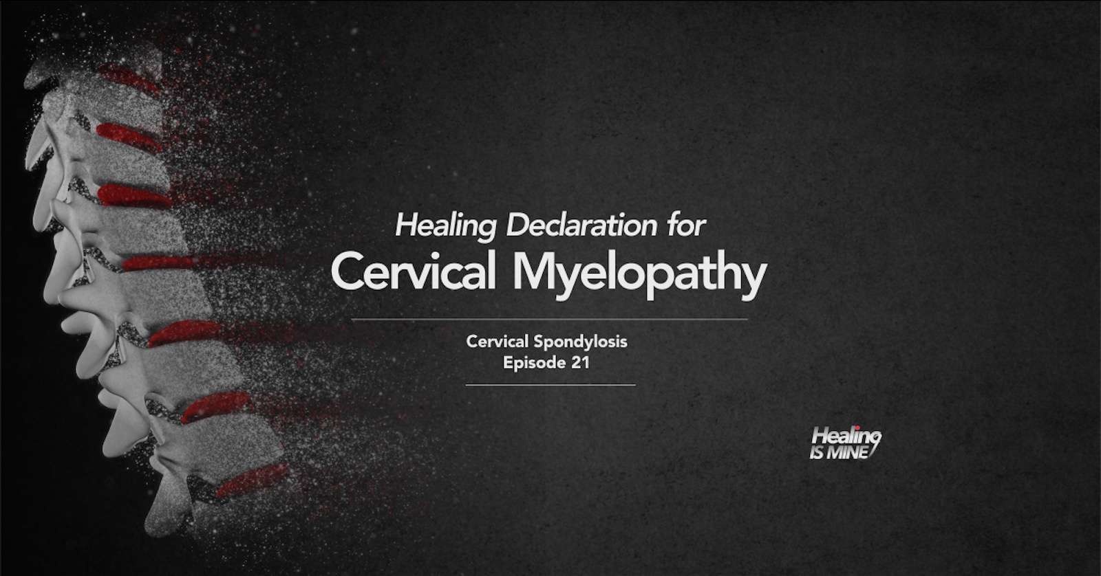 Cervical spine illustration showing spinal cord compression within narrowed spinal canal in cervical myelopathy