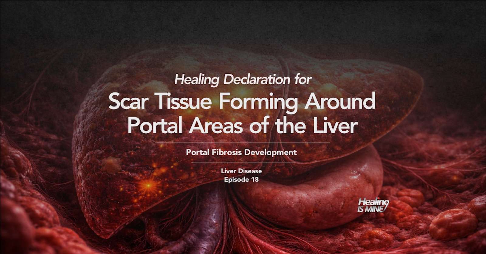 Illustration of liver tissue and fibrotic changes with the title “Scar Tissue Forming Around Portal Areas of the Liver (Portal Fibrosis Development) – Liver Disease Episode 18.”