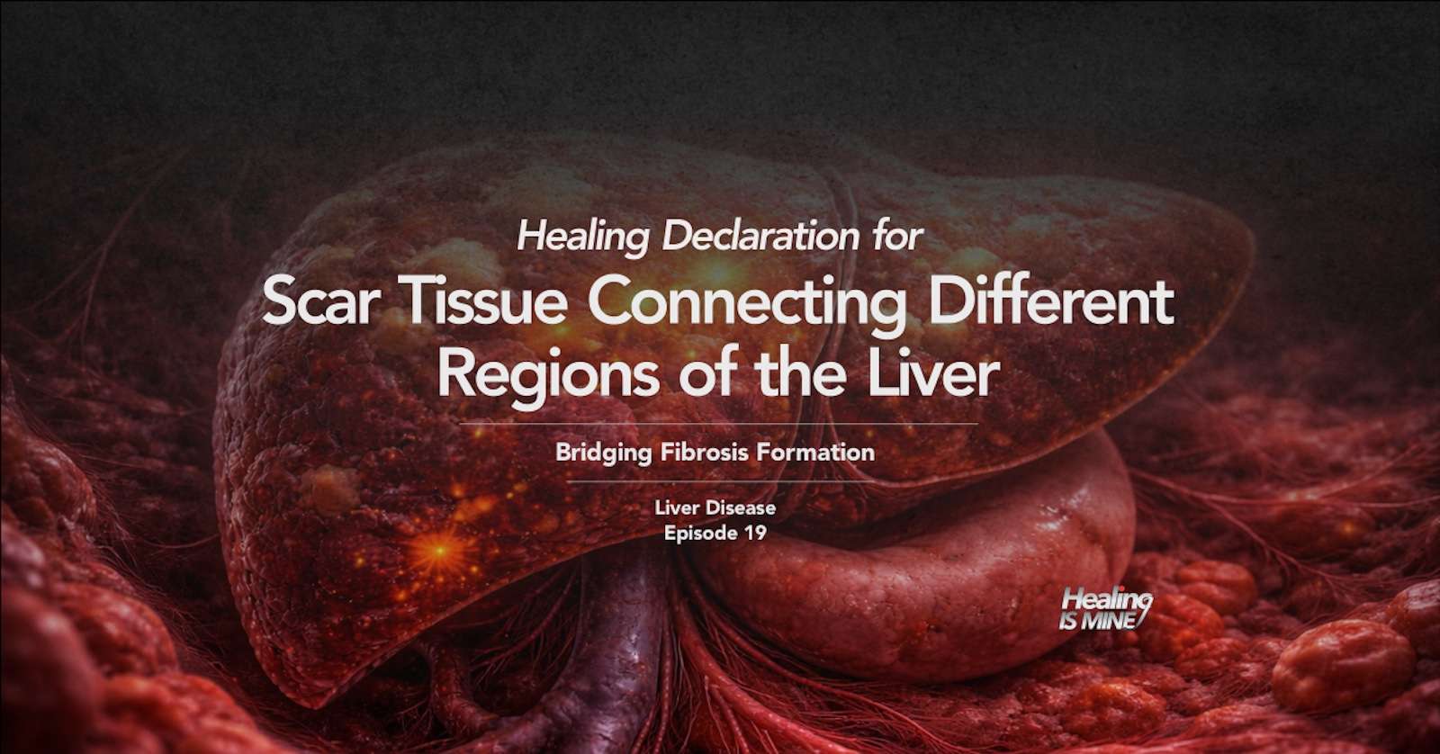 Illustration of liver tissue and fibrotic bridging with the title “Scar Tissue Connecting Different Regions of the Liver (Bridging Fibrosis Formation) – Liver Disease Episode 19.”