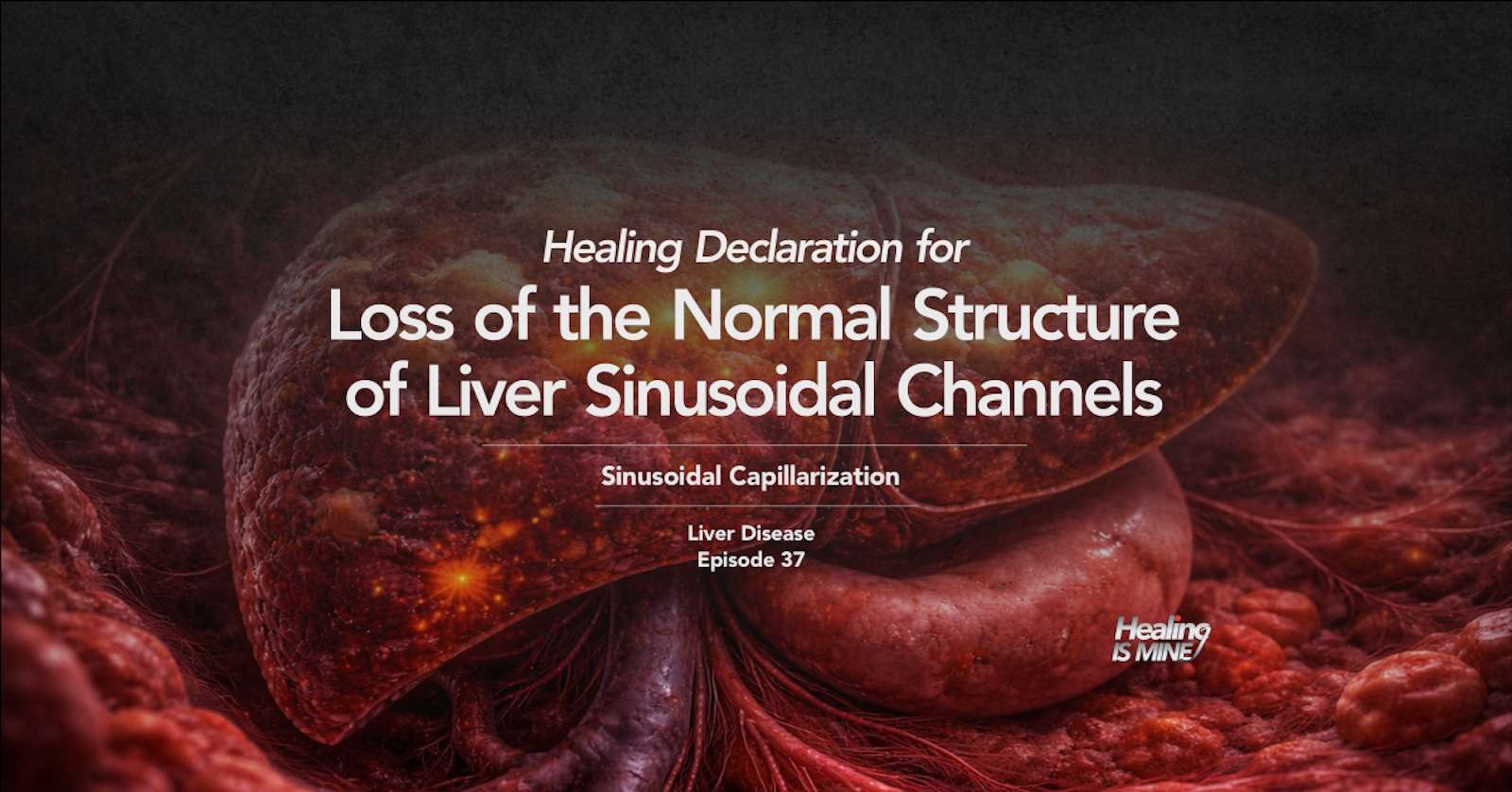 Illustration of the liver highlighting structural alteration of sinusoidal channels, titled “Loss of the Normal Structure of Liver Sinusoidal Channels (Sinusoidal Capillarization) – Liver Disease Episode 37.”